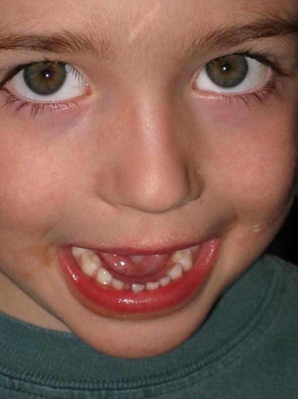 loose tooth.jpg